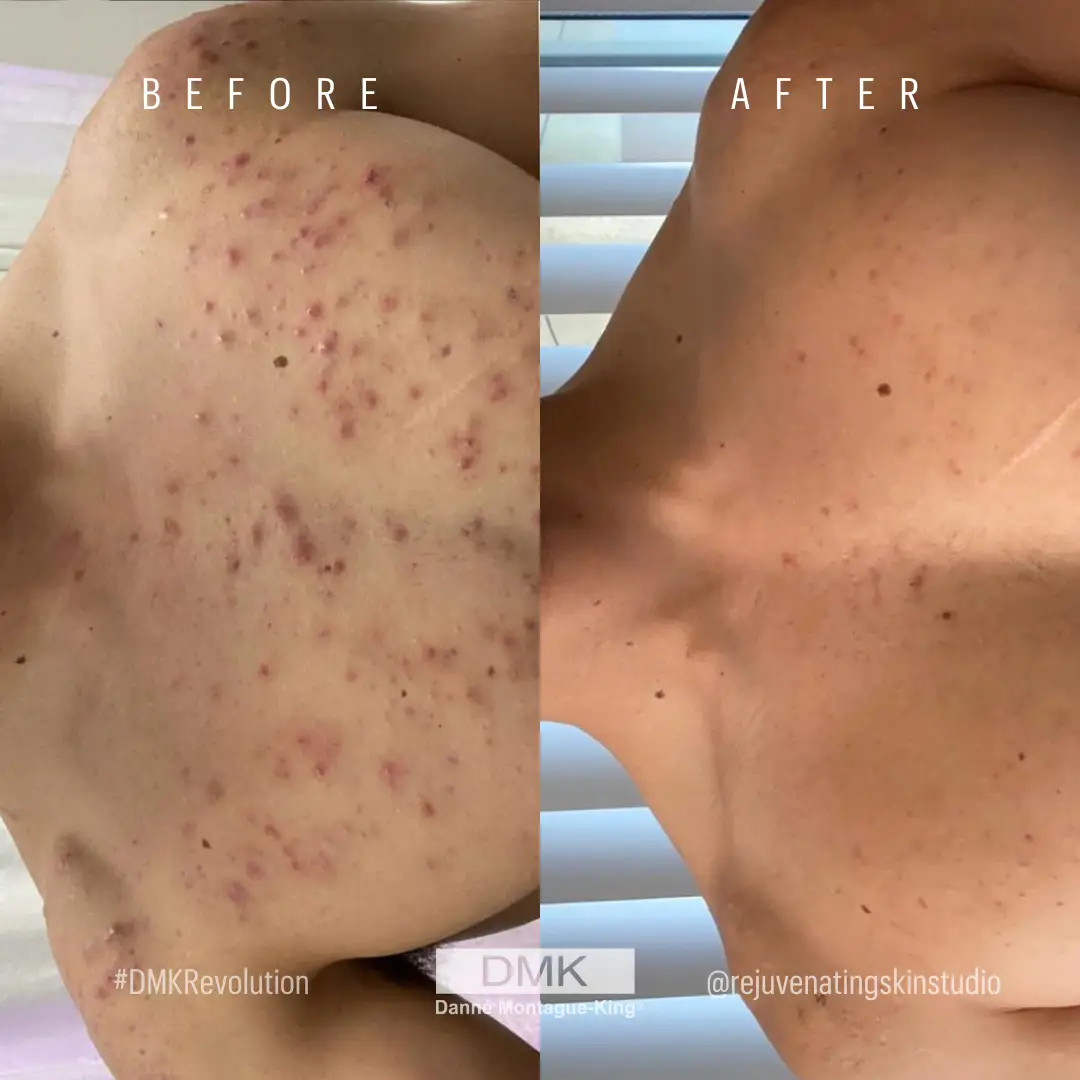 BodyMasque